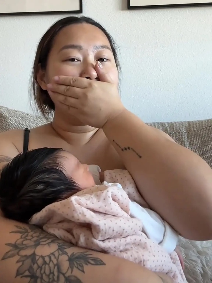 Mô vú tiềm ẩn và câu chuyện bất ngờ của bà mẹ có bầu ngực thứ ba sau sinh - Ảnh 3.