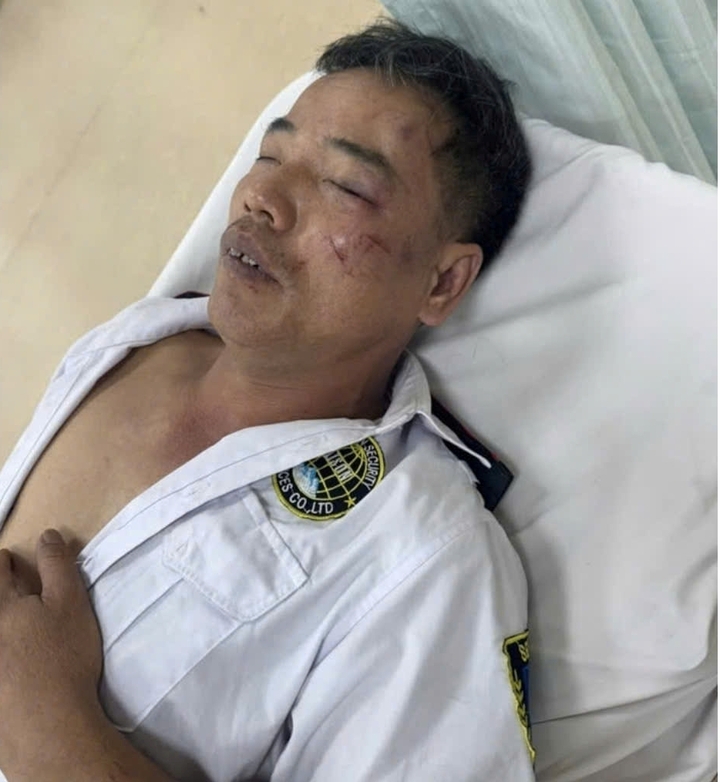 Nhóm thanh niên nẹt pô đánh bảo vệ gây thương tích nặng tại Tây Ninh - Ảnh 2.