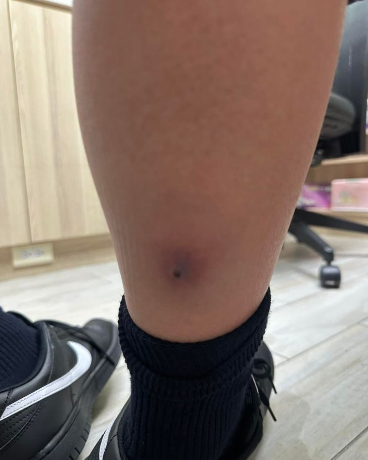 Cảnh báo sốt cao ở trẻ em: Bé trai 12 tuổi suýt mất mạng vì chủ quan với cúm mùa - Ảnh 2.