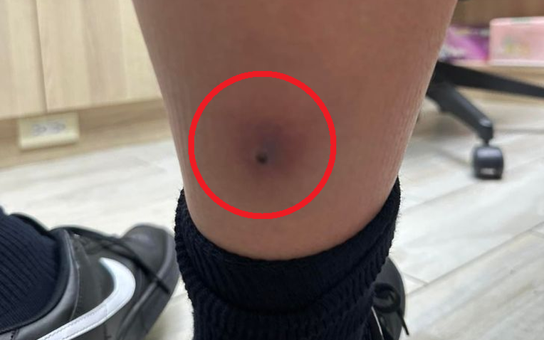 Cảnh báo sốt cao ở trẻ em: Bé trai 12 tuổi suýt mất mạng vì chủ quan với cúm mùa - Ảnh 1.