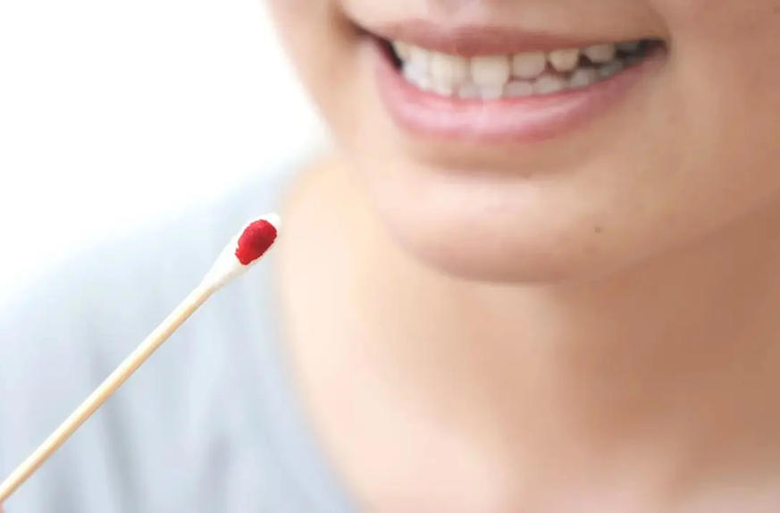 Bác sĩ cảnh báo 5 dấu hiệu ung thư sớm xuất hiện buổi sáng không thể bỏ qua - Ảnh 2.