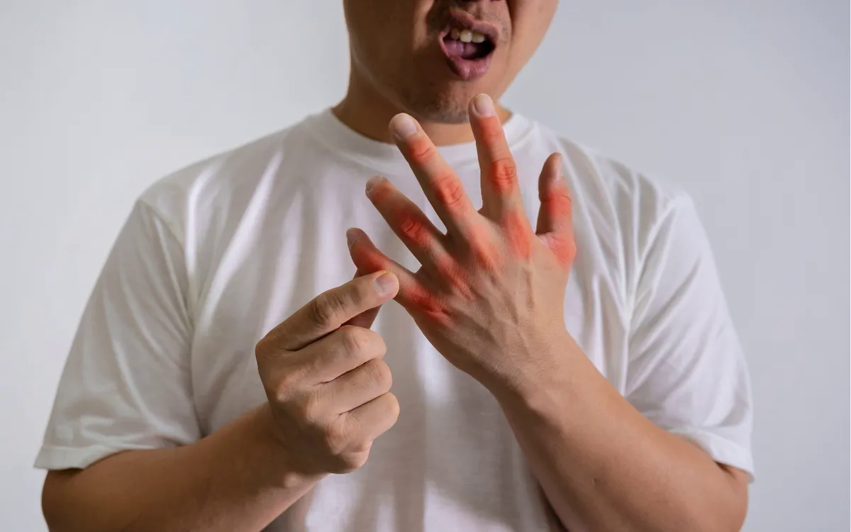 3 Bệnh lý chuyển hóa thường gặp sau Tết và cách phòng tránh hiệu quả năm 2026 - Ảnh 1.