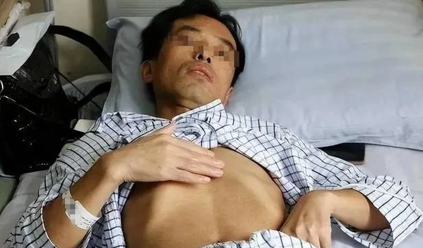 Người đàn ông mắc ung thư gan vì ngày nào cũng uống nước từ loại cốc nhiều người dùng mỗi ngày- Ảnh 1.