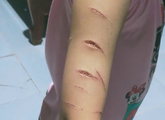 Học sinh lớp 5 bị chị họ dùng dao rạch tay: Nguyên nhân và hậu quả - Ảnh 1.