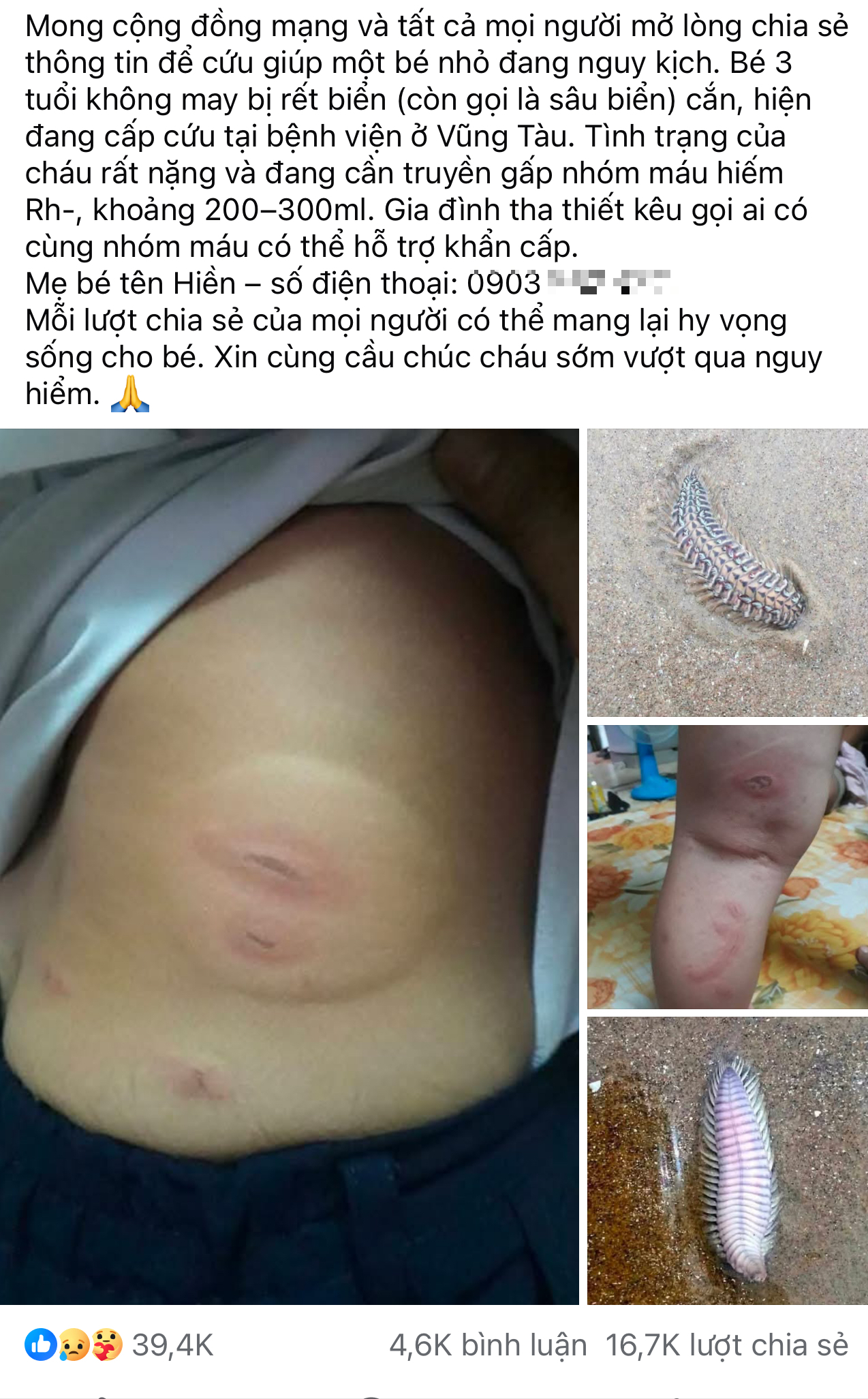 Thực hư thông tin bé 3 tuổi bị sâu biển cắn nguy kịch, gia đình tha thiết kêu gọi hỗ trợ máu hiếm