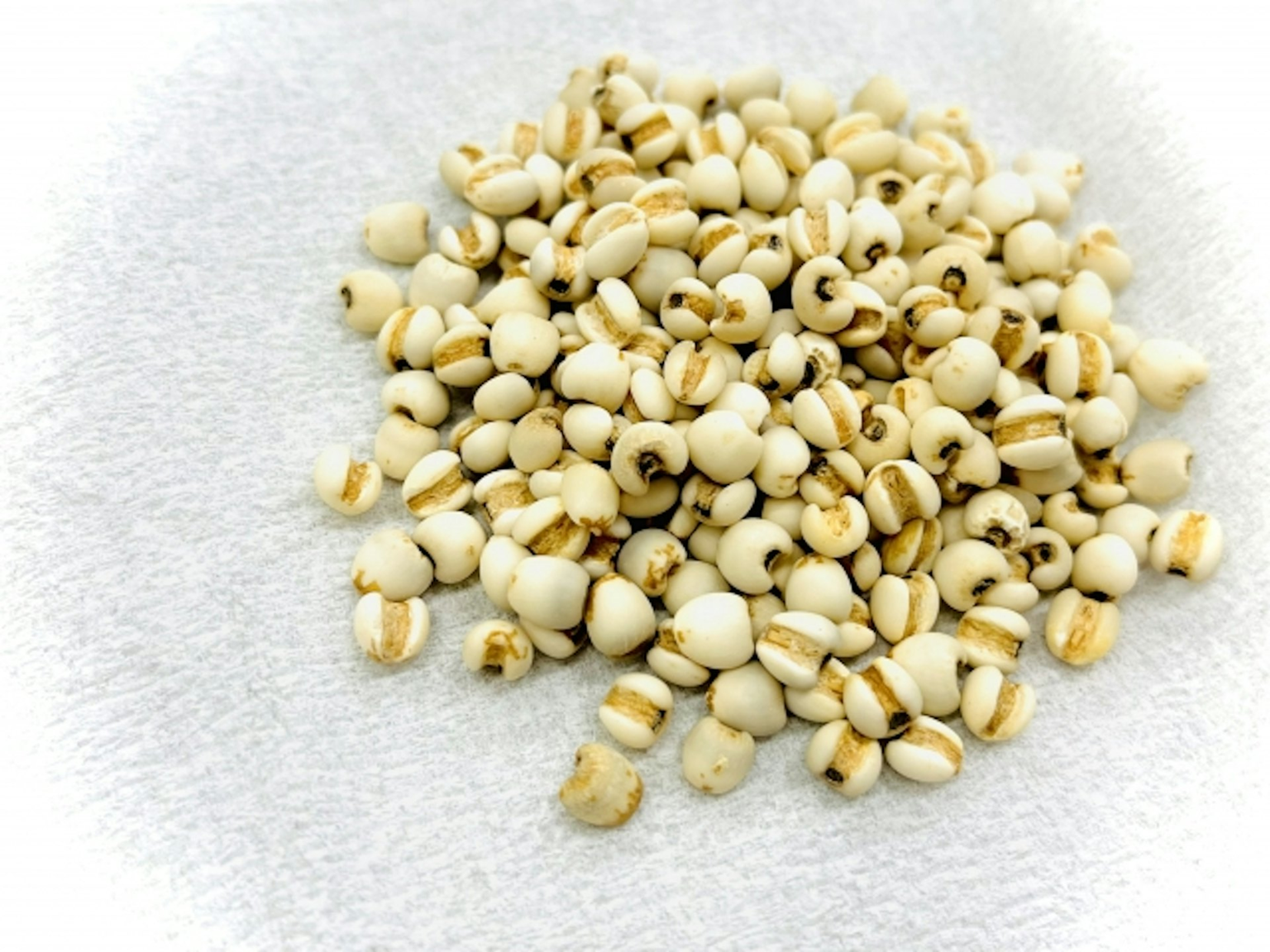 Giảm cân an toàn: Cô gái 28 tuổi mất chức năng thận vì thuốc lợi tiểu - Ảnh 2. Giảm cân an toàn: Cô gái 28 tuổi mất chức năng thận vì thuốc lợi tiểu - Ảnh 2.