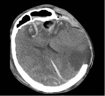 Cứu sống mẹ con du khách Nga bị tai nạn nghiêm trọng tại TPHCM - Ảnh 1.