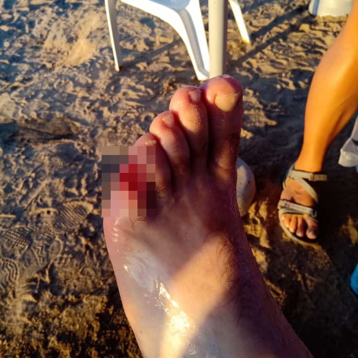 Nhiều người nhập viện vì bị đàn cá ăn thịt tấn công - Ảnh 1. Nhiều người nhập viện vì đàn cá ăn thịt cắn trên sông Paraná - Ảnh 1.