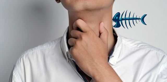 Hóc xương cá phải làm sao? 2 cách an toàn và hiệu quả bạn nên biết - Ảnh 2.