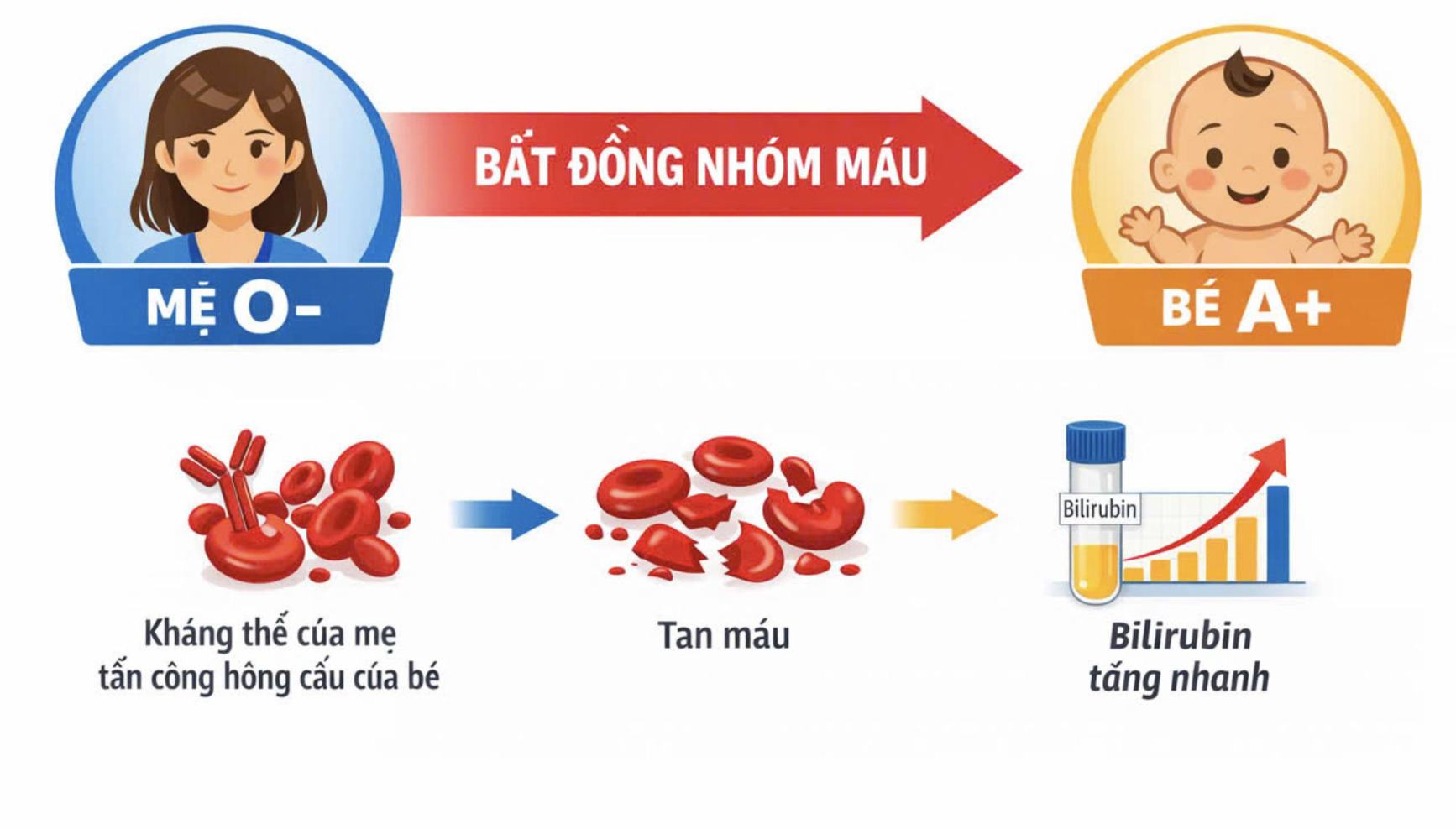 30 giờ sau sinh, bé sơ sinh phải thay máu vì vàng da sơ sinh nặng - Ảnh 2.
