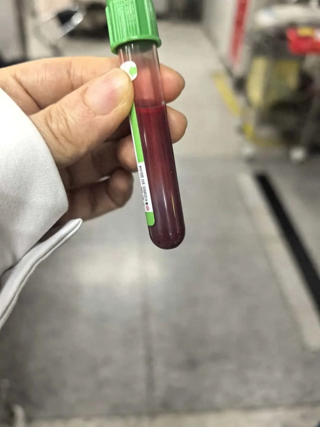 Mẹ bầu tăng 5kg chỉ Sau 1 tuần do ăn uống trong thai kỳ kém kiểm soát - Ảnh 1. Mẹ bầu tăng 5kg chỉ Sau 1 tuần do ăn uống trong thai kỳ kém kiểm soát - Ảnh 1.