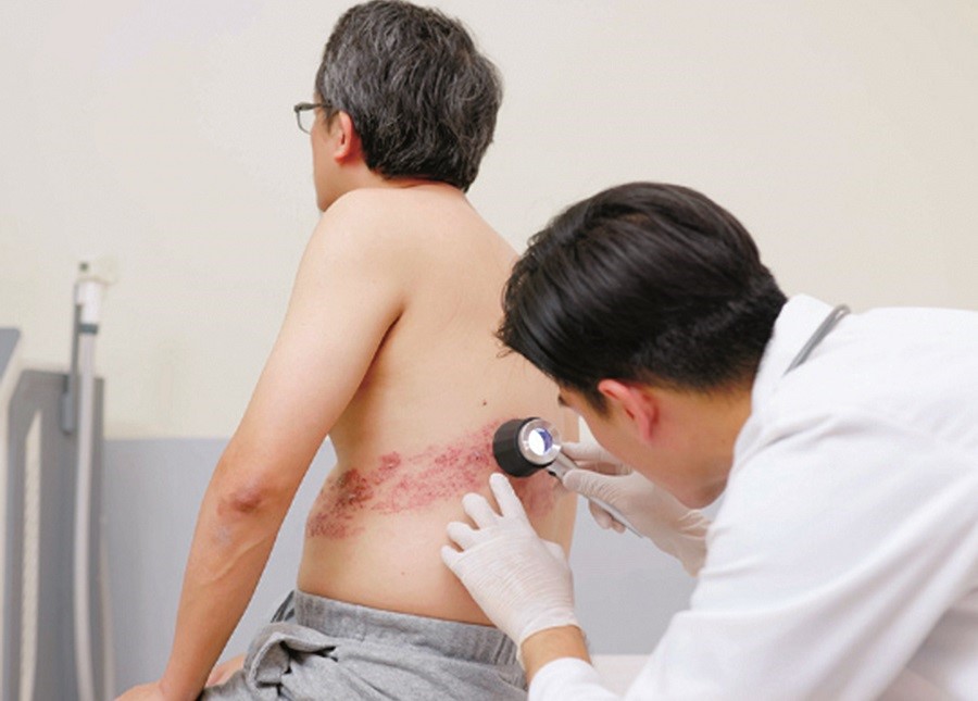 Khảo sát cho thấy 78 % người lớn tuổi lo sợ bệnh zona ảnh hưởng đến cuộc sống - Ảnh 1. Khảo sát cho thấy 78 % người lớn tuổi lo sợ bệnh zona ảnh hưởng đến cuộc sống - Ảnh 1.