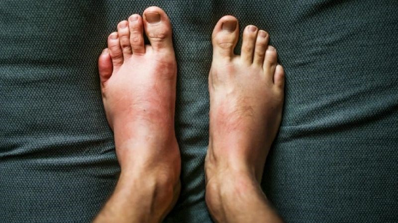 Cảnh báo 8 dấu hiệu thận yếu ở nam giới vào buổi sáng không nên bỏ qua - Ảnh 3. Cảnh báo 8 dấu hiệu thận yếu ở nam giới vào buổi sáng không nên bỏ qua - Ảnh 3.