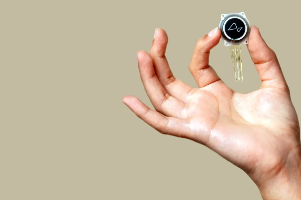 Elon Musk và sai lầm Neuralink: 300 . 000 Bệnh nhân có vỡ mộng không? - Ảnh 4. Elon Musk và sai lầm Neuralink: 300 . 000 Bệnh nhân có vỡ mộng không? - Ảnh 4.