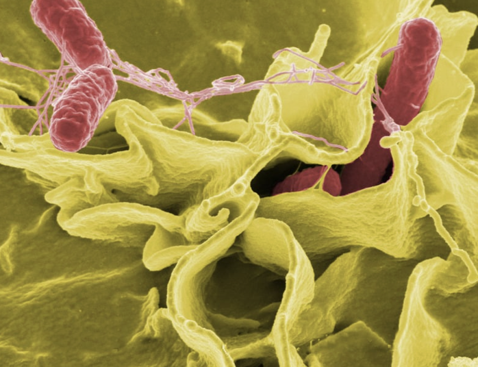 Tất cả bệnh nhi nhập viện nội trú do nghi ngộ độc hiện ra sao? - Ảnh 1.