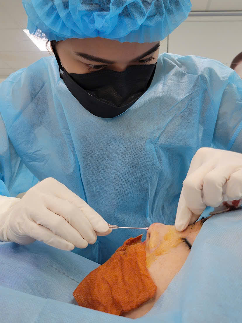 Phẫu thuật thẩm mỹ biến chứng gia tăng: Chế tài chưa đủ sức răn đe - Ảnh 4.