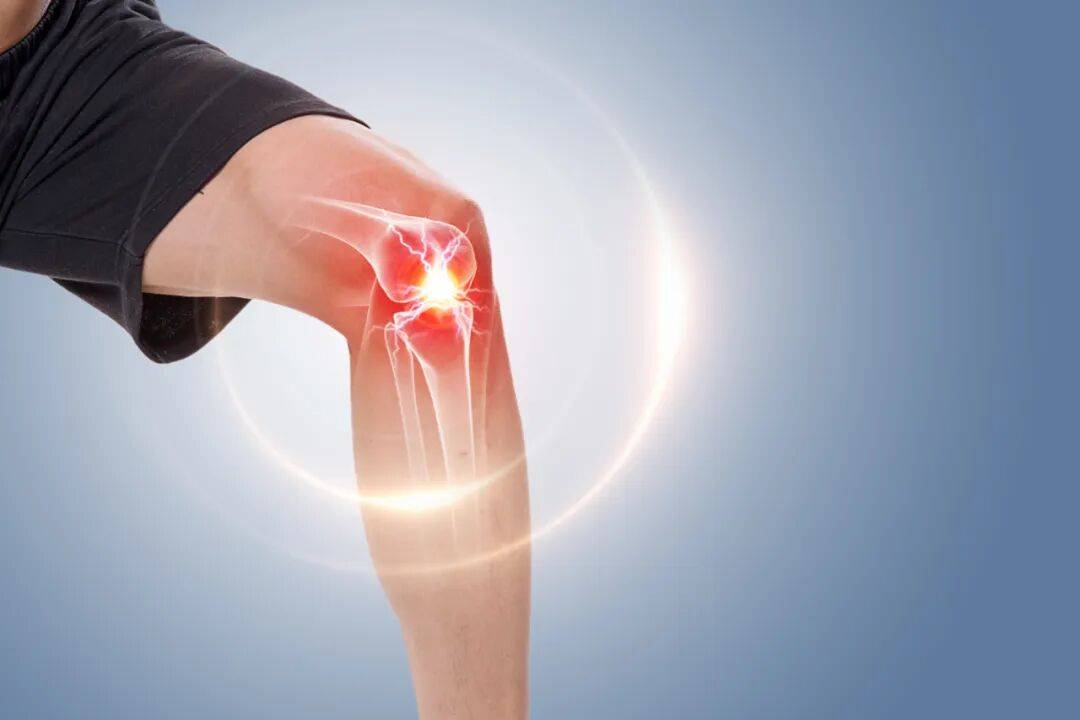 Đừng đợi đến khi không thể ngồi xổm hay leo cầu thang mới lo giữ đầu gối: 5 dấu hiệu cảnh báo khớp gối đang lão hóa- Ảnh 1.