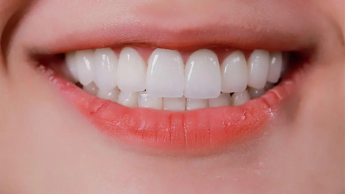 Vì sao lấy cao răng không làm mòn răng: Giải mã hiểu lầm lớn về chăm sóc răng miệng - Ảnh 3. Vì sao lấy cao răng không làm mòn răng: Giải mã hiểu lầm lớn về chăm sóc răng miệng - Ảnh 3.