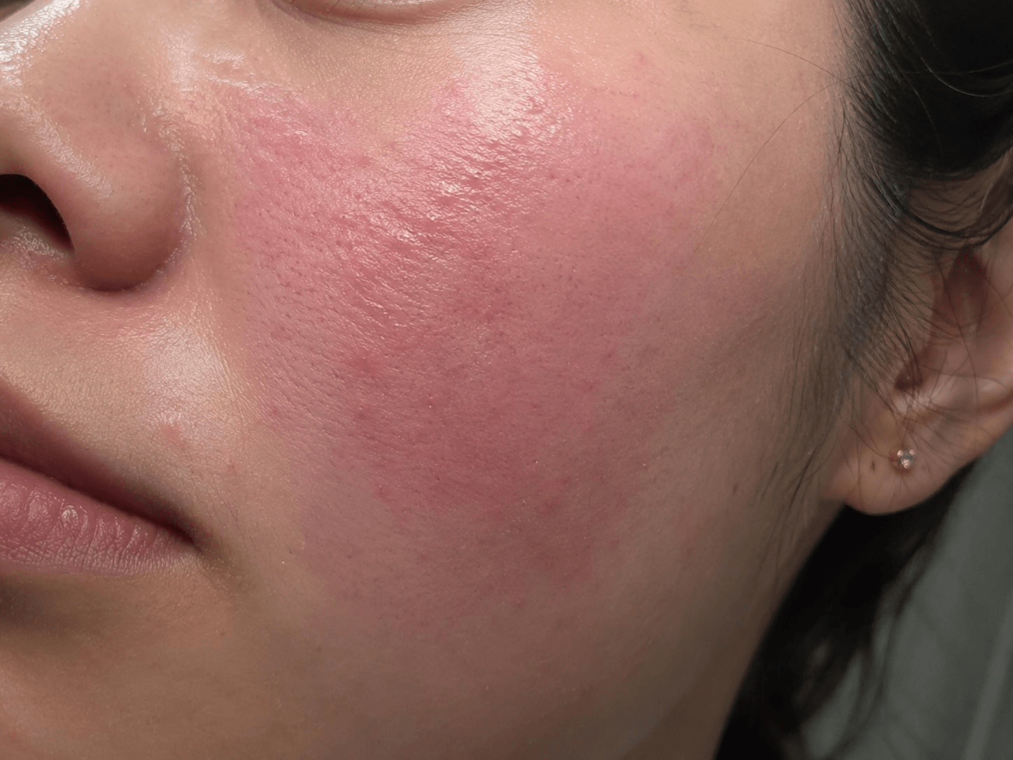 Peptide vs Retinol: Cuộc chiến chống lão hóa năm 2026 - Ảnh 2.