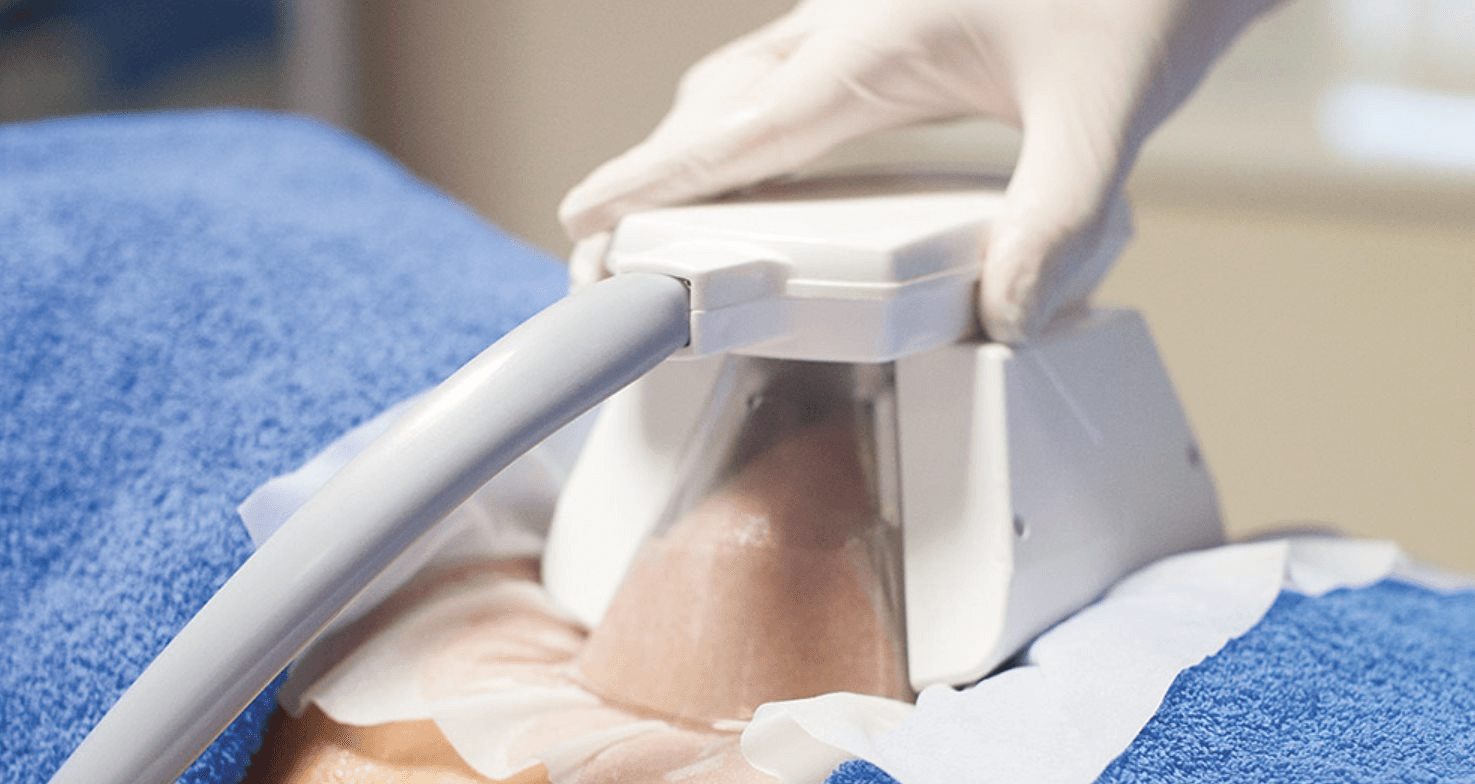 Công nghệ đông lạnh mỡ cryolipolysis: Sự thay đổi trong ngành thẩm mỹ năm 2026 - Ảnh 1.