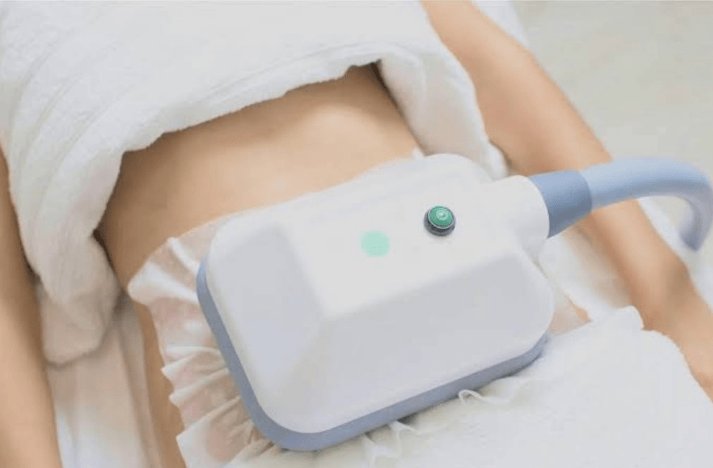 Công nghệ đông lạnh mỡ cryolipolysis: Sự thay đổi trong ngành thẩm mỹ năm 2026 - Ảnh 3.