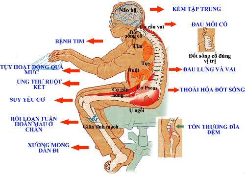 Sự thật sau 8 tiếng làm việc: Dân văn phòng ngồi quá nhiều, cái chết từ từ rồi sẽ đến, kể cả có cố tập thể dục! - Ảnh 1.