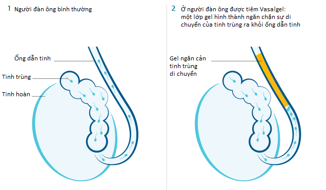 Cơ chế hoạt động của Vasalgel