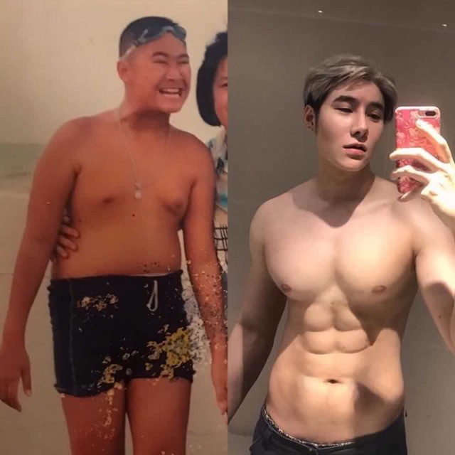 Trào lưu phẫu thuật thẩm mỹ mới: Body 6 múi sexy không cần phải tập cũng có! - Ảnh 15. Trào lưu phẫu thuật thẩm mỹ mới: Body 6 múi sexy không cần phải tập cũng có! - Ảnh 15.