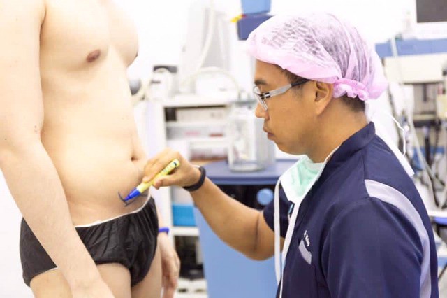 Trào lưu phẫu thuật thẩm mỹ mới: Body 6 múi sexy không cần phải tập cũng có! - Ảnh 7. Trào lưu phẫu thuật thẩm mỹ mới: Body 6 múi sexy không cần phải tập cũng có! - Ảnh 7.