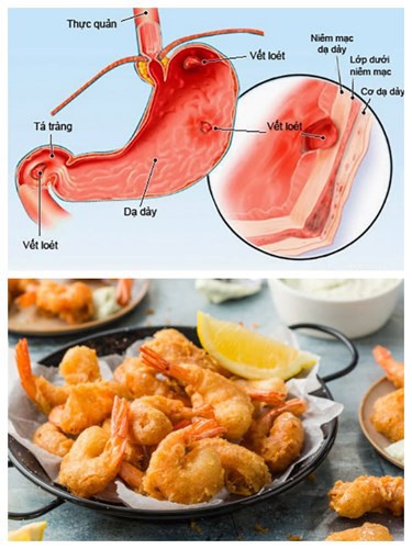 Thói quen hàng ngày có thể gây hại cho các cơ quan đặc biệt của cơ thể - Ảnh 1. Thói quen hàng ngày có thể gây hại cho các cơ quan đặc biệt của cơ thể - Ảnh 1.