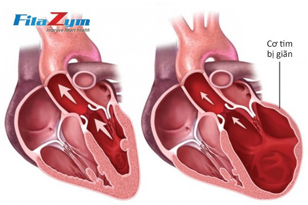  Các dấu hiệu tố bệnh tim bạn không nên bỏ qua - Ảnh 1.