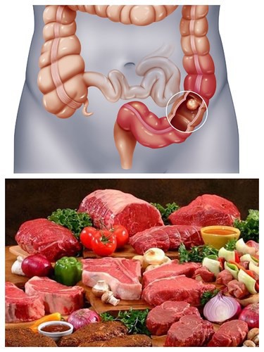 Thói quen hàng ngày có thể gây hại cho các cơ quan đặc biệt của cơ thể - Ảnh 4. Thói quen hàng ngày có thể gây hại cho các cơ quan đặc biệt của cơ thể - Ảnh 4.