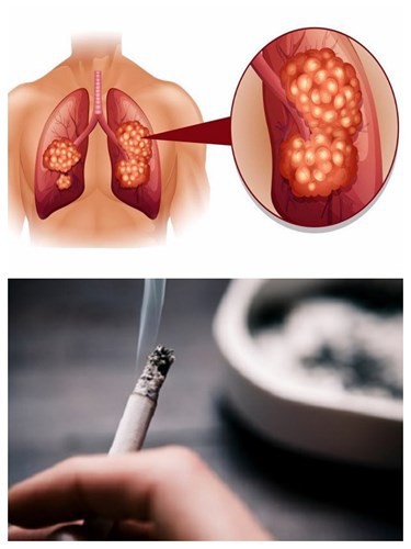Thói quen hàng ngày có thể gây hại cho các cơ quan đặc biệt của cơ thể - Ảnh 7. Thói quen hàng ngày có thể gây hại cho các cơ quan đặc biệt của cơ thể - Ảnh 7.