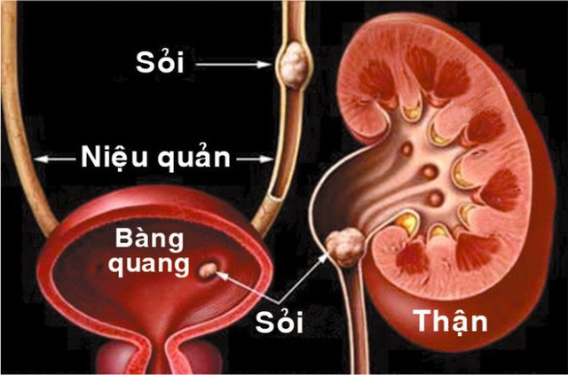 Mỗi người chỉ có hai quả thận, đừng vì thói quen xấu này mà mất nó  - Ảnh 1.