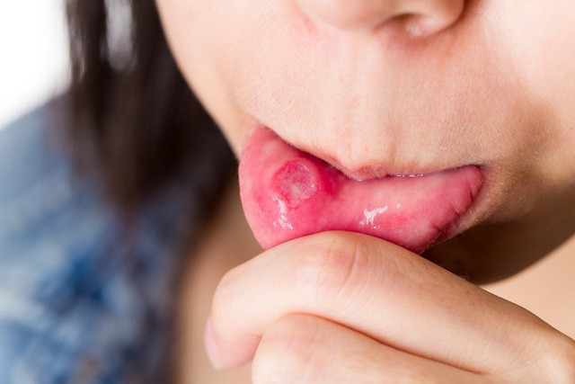 Tưởng bình thường nhưng hóa ra đây đều là những biểu hiện cảnh báo ung thư đang phát triển trong cơ thể bạn - Ảnh 1. Tưởng bình thường nhưng hóa ra đây đều là những biểu hiện cảnh báo ung thư đang phát triển trong cơ thể bạn - Ảnh 1.