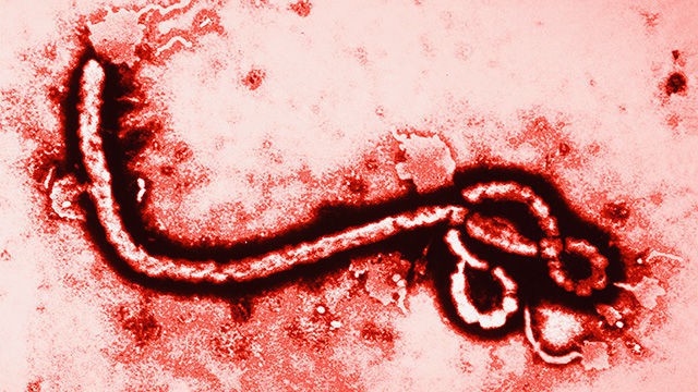 Nguy hiểm hơn Ebola, những người nhiễm bệnh sẽ cười điên loạn như Joker rồi chết - Ảnh 2.