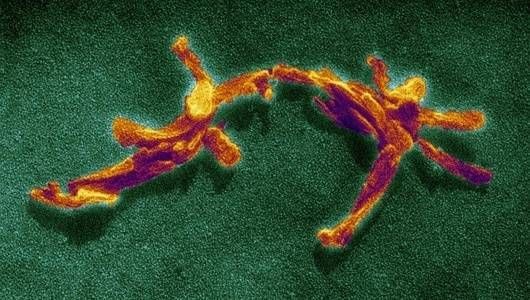 Nguy hiểm hơn Ebola, những người nhiễm bệnh sẽ cười điên loạn như Joker rồi chết - Ảnh 9. Nguy hiểm hơn Ebola, những người nhiễm bệnh sẽ cười điên loạn như Joker rồi chết - Ảnh 9.