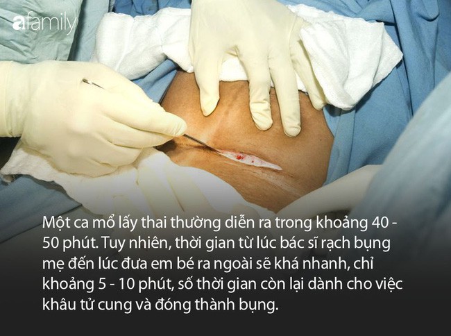 Quy trình sinh mổ: Hành trình an toàn cho mẹ và bé