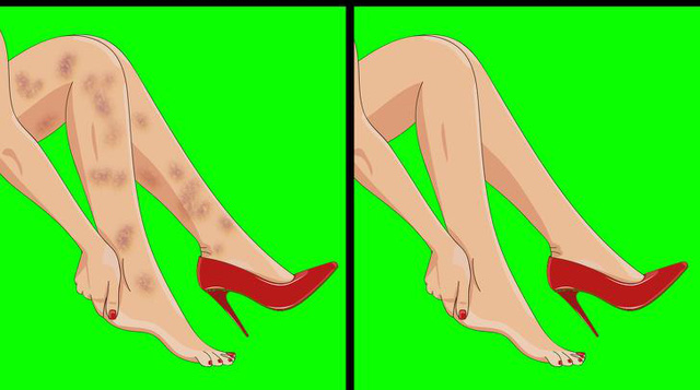  Xuất hiện 6 dấu hiệu này ở chân, bạn nên sớm đi gặp bác sĩ bởi sức khỏe đang gặp vấn đề nghiêm trọng - Ảnh 1.
