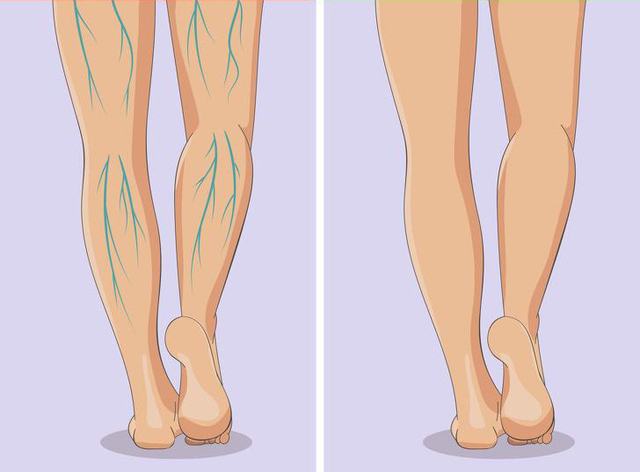  Xuất hiện 6 dấu hiệu này ở chân, bạn nên sớm đi gặp bác sĩ bởi sức khỏe đang gặp vấn đề nghiêm trọng - Ảnh 3.