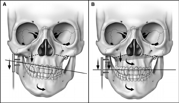 5 thói quen làm cho bạn trở nên xấu, già, ốm, bệnh: Ai muốn trẻ khỏe thì nên thay đổi ngay - Ảnh 2.