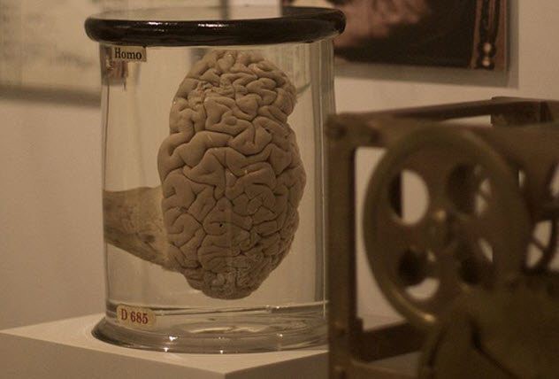 Câu chuyện về những thứ kỳ quái nhất từng được đem ra trưng bày trong bảo tàng: Não, thủ cấp và bộ phận sinh dục con người - Ảnh 4.