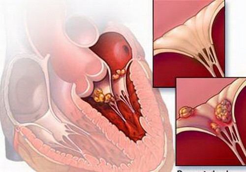  Có triệu chứng giống cảm cúm nhưng xuất hiện thêm dấu hiệu này: Đến viện gấp kẻo nguy kịch - Ảnh 2.