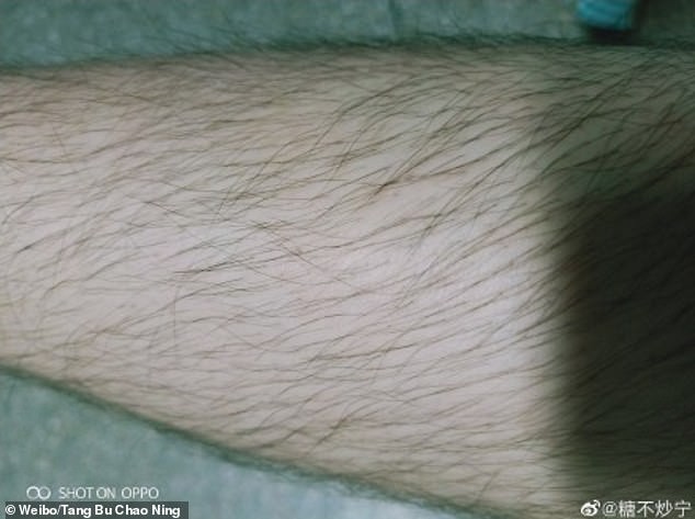 Các thiếu nữ Trung Quốc thi nhau khoe lông tay, lông chân dày đến mức muỗi cũng không đốt nổi - Ảnh 7.