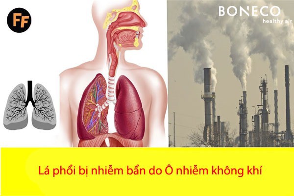 Số người mắc bệnh hô hấp tử vong vì ô nhiễm không khí nhiều mức nào? - Ảnh 1.
