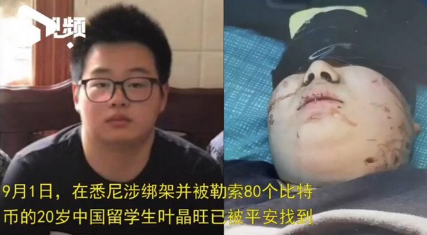 Du học sinh Trung Quốc bị bắt cóc ở Úc, gia đình nạn nhân khổ sở vì bị bắt trả tiền chuộc bằng 80 Bitcoin - Ảnh 1.
