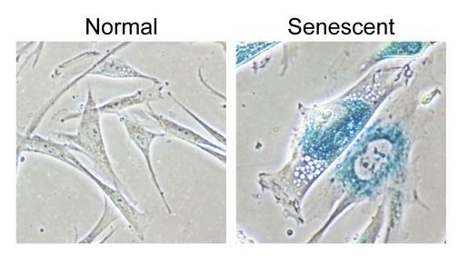 Senolytics: Lĩnh vực khoa học mới nổi giúp con người trẻ mãi không già - Ảnh 1.