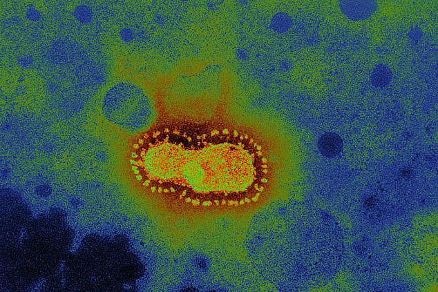 Virus corona từng được dự đoán sẽ giết 65 triệu người/năm trên thế giới chỉ 3 THÁNG trước khi thành dịch: Nguy hiểm hơn, nó có thể lây qua MẮT! - Ảnh 1.