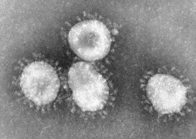  Thợ săn Virus: Những người đầu tiên tìm ra danh tính virus lạ, luôn phải đối mặt với sự nguy hiểm và hàng loạt áp lực từ công chúng  - Ảnh 6.