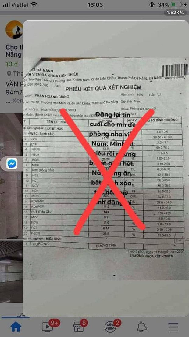 Nam bệnh nhân tự sửa kết quả xét nghiệm từ sốt xuất huyết sang dương tính virus Corona để thu hút sự chú ý - Ảnh 2.